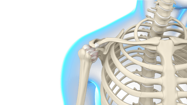 Treating Frozen Shoulder & Range-of-Motion Shoulder Injuries — RS Medical