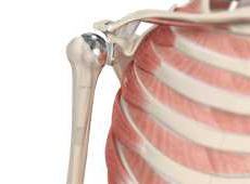 Shoulder Joint Replacement